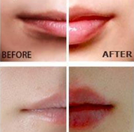 Miracle Lip Plumper Miracle Lip Plumper Miracle Lip Plumper Miracle Lip Plumper